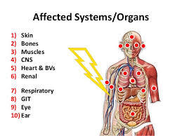 electrical_injury_systems_organs.jpeg